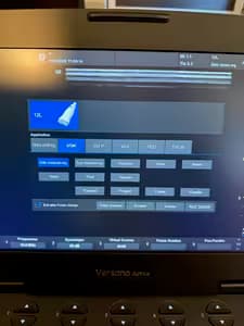 Echographe portable ge versana active