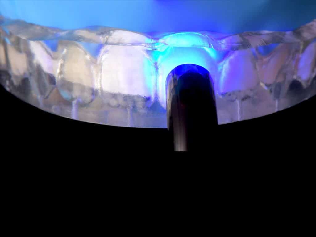 Composites injectés : l'esthétique à la portée de tous